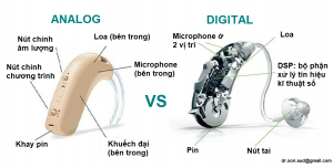 máy trợ thính analog và digital