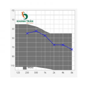 máy trợ thính công suất cao