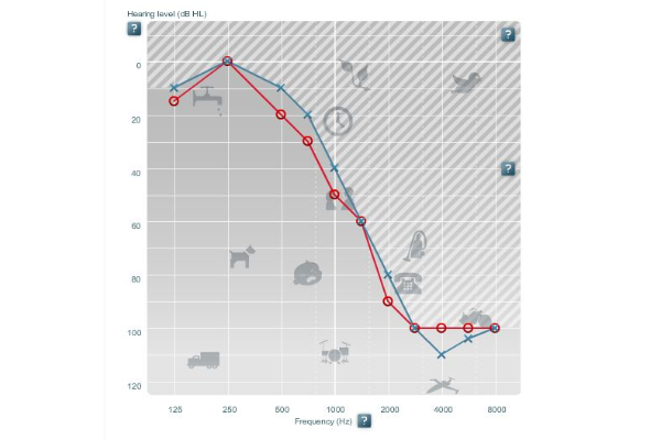 âm thanh phổ biến