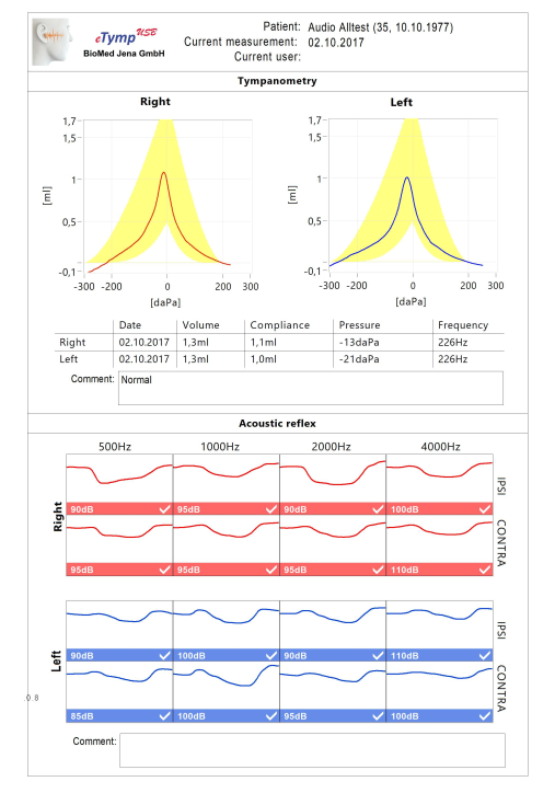 Thiết bị đánh giá chức năng tai giữa