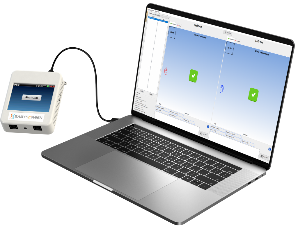 máy đo thính lực sàng lọc babyscreen