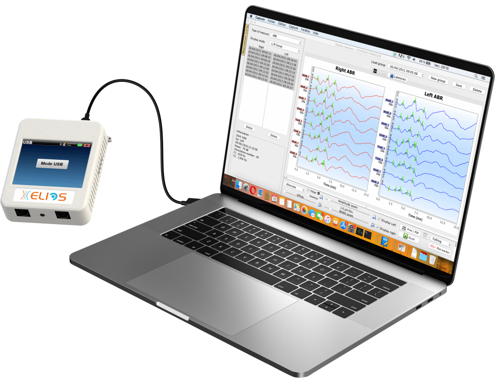 máy đo thính lực đa năng Elios