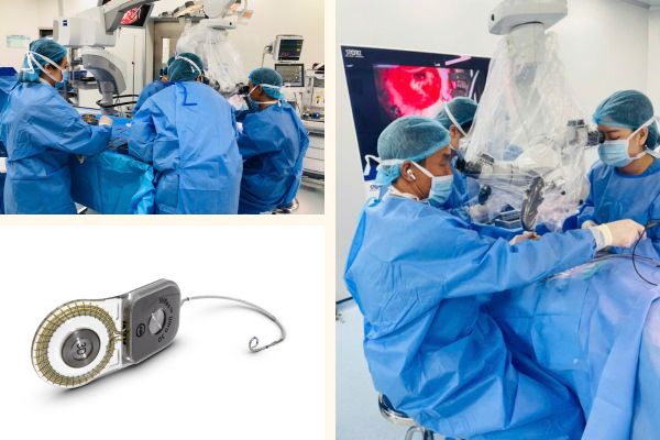 cay-ghep-oc-tai-dien-tu